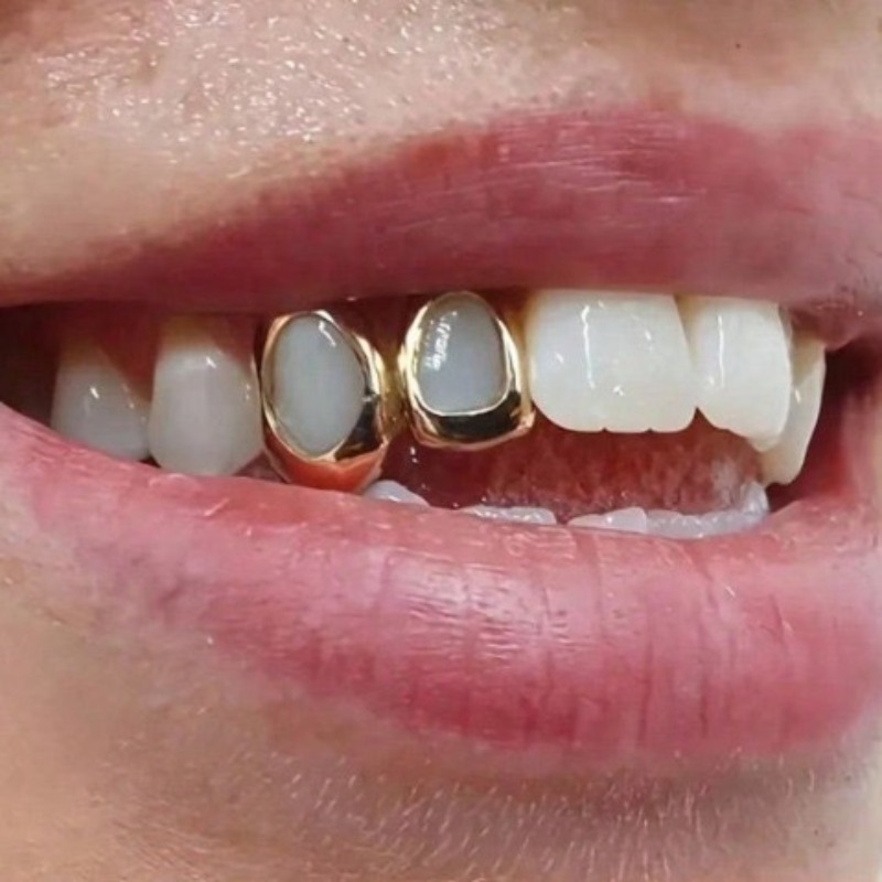 Conjunto de Joias Dentárias Go - Body Jewelry Changing Kit avaliação e preço